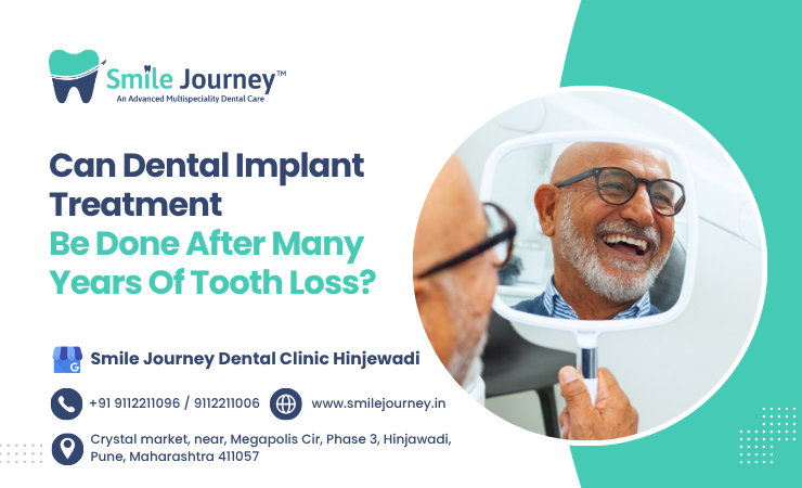 Can Dental Implant Treatment Be Done After Many Years Of Tooth Loss?