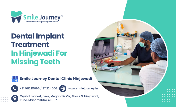 dental implant treatment in hinjewadi for missing teeth