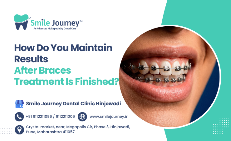 How do you maintain results after braces treatment is finished?