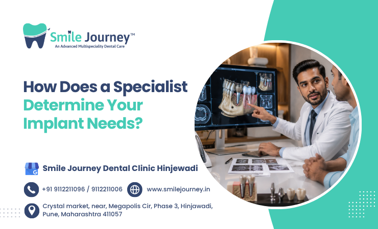How Does A Specialist Determine Your Implant Needs?