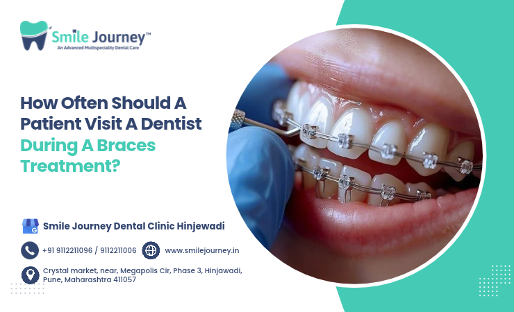 How Often Should A Patient Visit A Dentist During A Braces Treatment ?