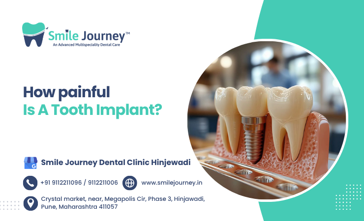 dental implant treatment