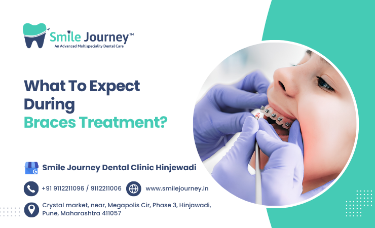 braces treatment