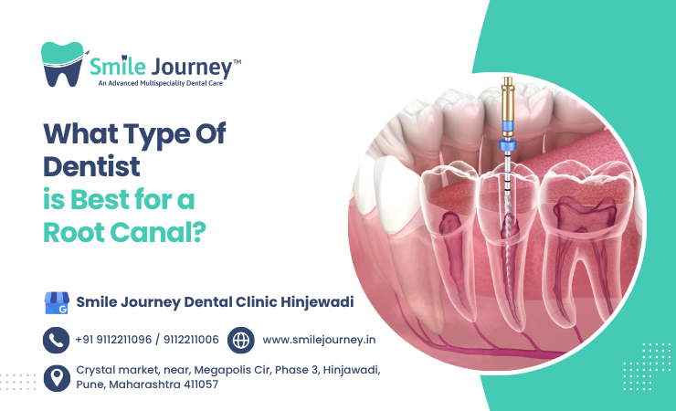 root canal specialist