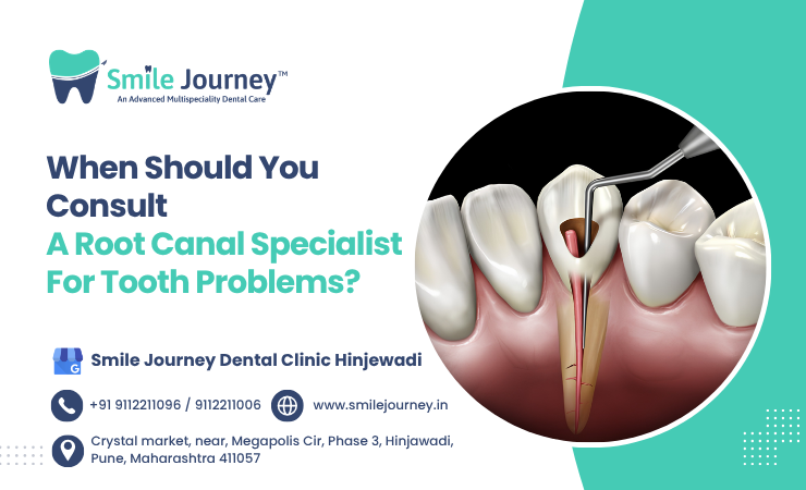 When should you consult a root canal specialist for tooth problems?