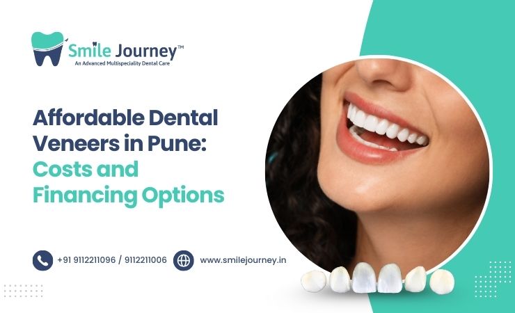 Affordable Dental Veneers in Pune: Costs and Financing Options