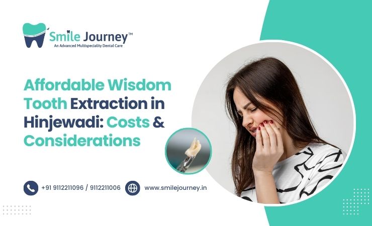 Affordable Wisdom Tooth Extraction in Hinjewadi: Costs and Considerations