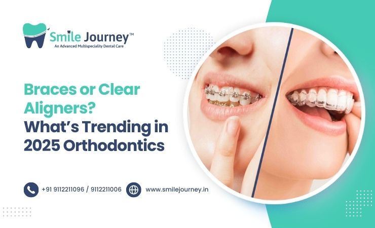 Braces or Clear Aligners? What’s Trending in 2025 Orthodontics