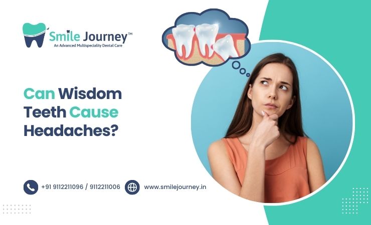 Can Wisdom Teeth Cause Headaches