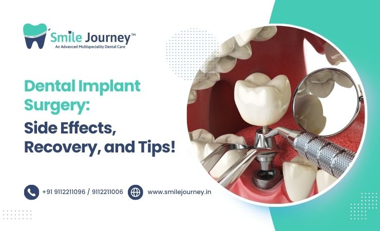 Dental Implant Surgery: Side Effects, Recovery, and Tips
