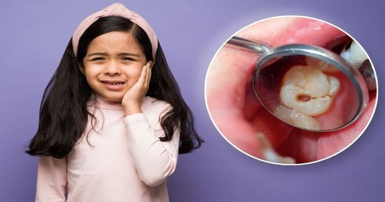 Effective Strategies for Preventing Cavities in Kids