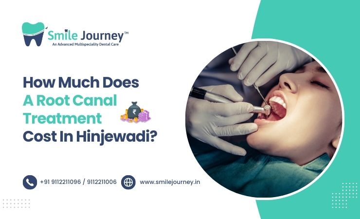 How Much Does A Root Canal Treatment Cost In Hinjewadi?