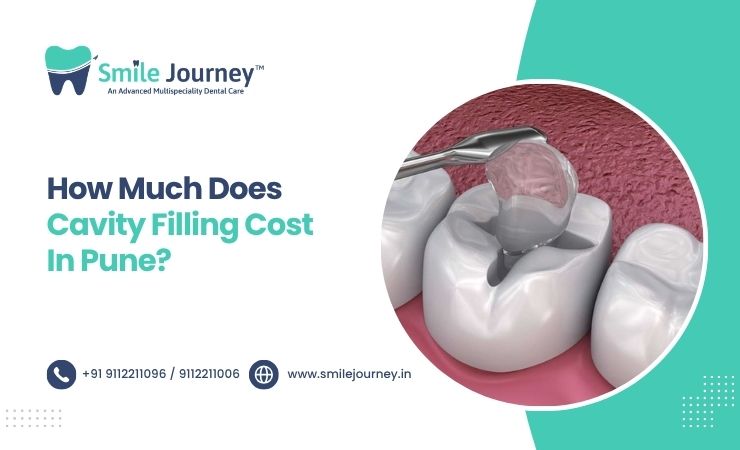 cavity filling cost in hinjewadi