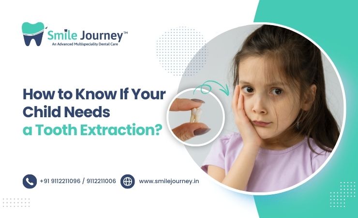 How to Know If Your Child Needs a Tooth Extraction