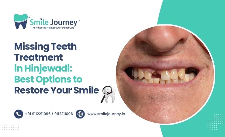missing teeth treatment in Hinjewadi