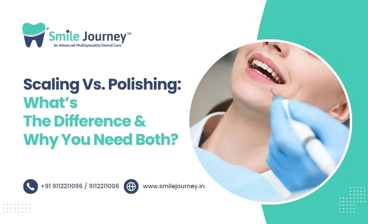 Scaling vs. Polishing: What’s the Difference and Why You Need Both