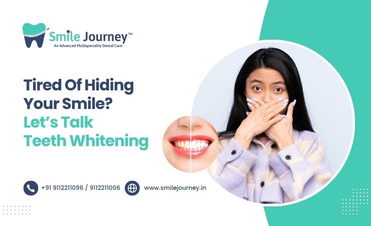 Tired of Hiding Your Smile? Let’s Talk Teeth Whitening