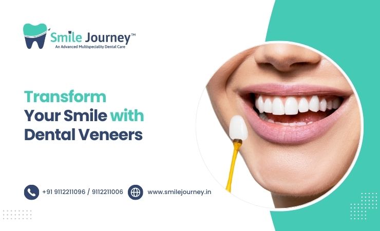 Transform Your Smile with Dental Veneers