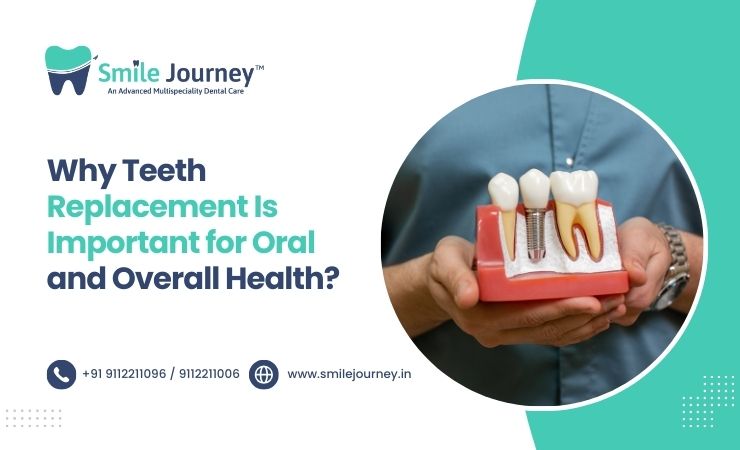 teeth replacement in hinjewadi